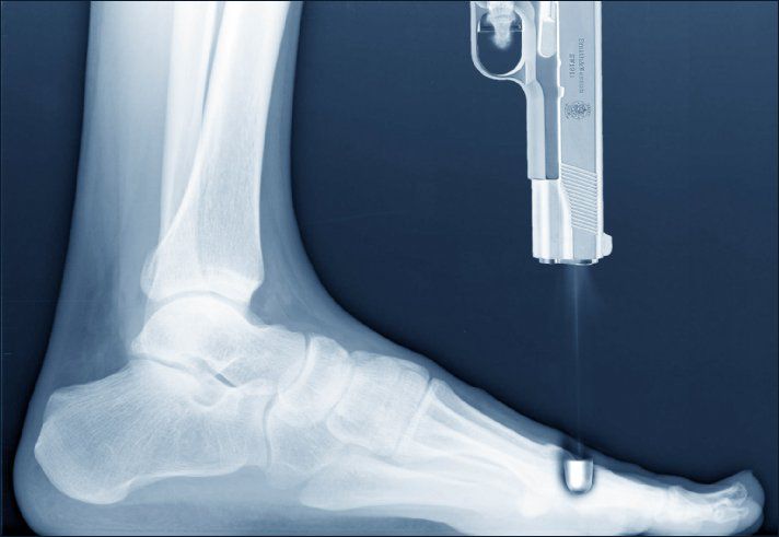 Image result for shooting your foot